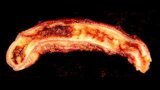 The appendix might actually be the body's bacteria storehouse
